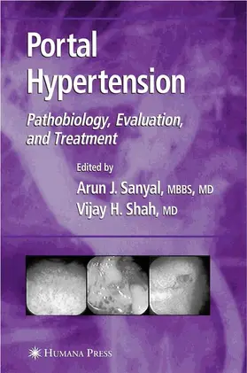 Sanyal / Shah |  Portal Hypertension | Buch |  Sack Fachmedien