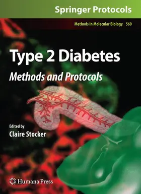 Stocker |  Type 2 Diabetes | Buch |  Sack Fachmedien