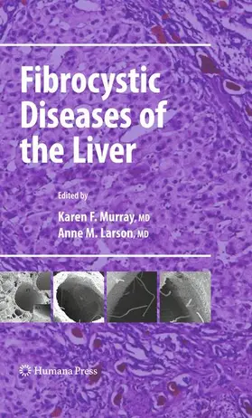 Larson / Murray |  Fibrocystic Diseases of the Liver | Buch |  Sack Fachmedien