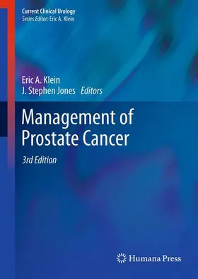 Jones / Klein | Management of Prostate Cancer | Buch | 978-1-61779-739-2 | sack.de