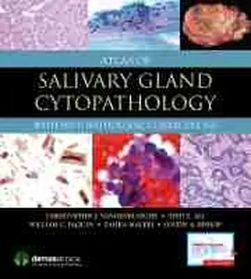 Vandenbussche / Ali / Faquin |  Atlas of Salivary Gland Cytopathology | Buch |  Sack Fachmedien