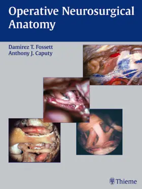 Fossett / Caputy |  Operative Neurosurgical Anatomy | eBook | Sack Fachmedien