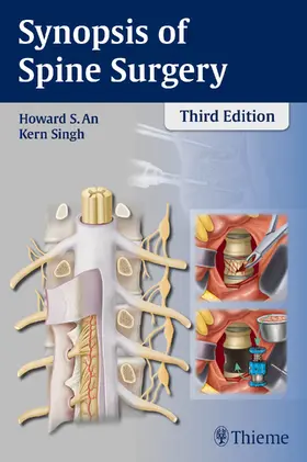 An / Singh |  Synopsis of Spine Surgery | Buch |  Sack Fachmedien