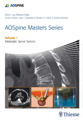 Boriani |  AOSpine Masters Series, Volume 1: Metastatic Spinal Tumors | eBook | Sack Fachmedien