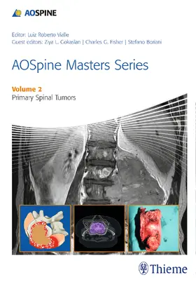 Boriani |  AOSpine Masters Series, Volume 2: Primary Spinal Tumors | eBook | Sack Fachmedien