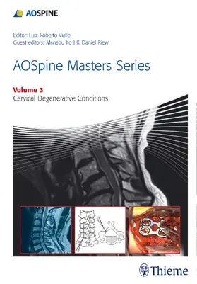 Riew / Ito | AOSpine Masters Series, Volume 3: Cervical Degenerative Conditions | E-Book | sack.de