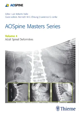 Lenke / Cheung / Vialle | Aospine Master Series, Vol. 4: Adult Spinal Deformities | Buch | 978-1-62623-100-9 | sack.de