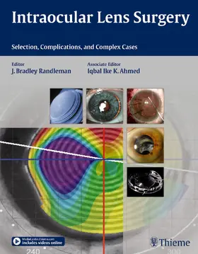 Randleman / Ahmed |  Intraocular Lens Surgery | eBook | Sack Fachmedien