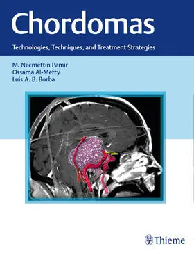 Pamir / Al-Mefty / Borba | Chordomas | Buch | 978-1-62623-159-7 | sack.de