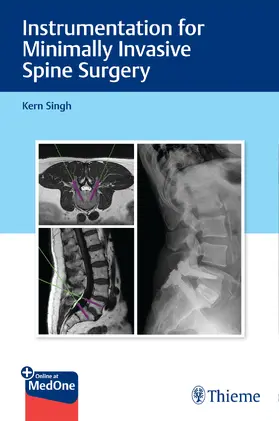 Singh | Instrumentation for Minimally Invasive Spine Surgery | E-Book | sack.de