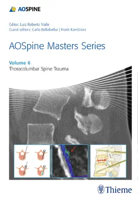Bellabarba / Kandziora |  AOSpine Masters Series, Volume 6: Thoracolumbar Spine Trauma | eBook | Sack Fachmedien