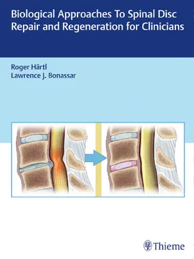 Hartl / Bonassar |  Biological Approaches to Spinal Disc Repair and Regeneration for Clinicians | eBook | Sack Fachmedien
