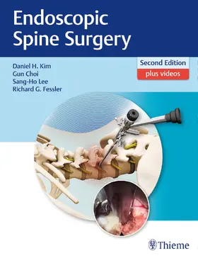 Kim / Choi / Lee |  Endoscopic Spine Surgery | Buch |  Sack Fachmedien