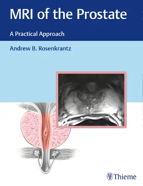 Rosenkrantz | MRI of the Prostate | Buch | 978-1-62623-268-6 | sack.de