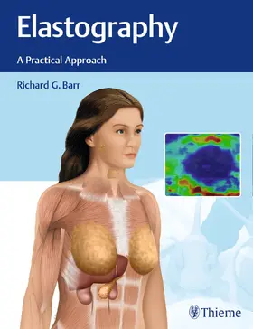 Barr |  Elastography | Buch |  Sack Fachmedien