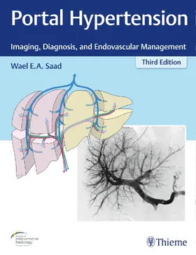 Saad |  Portal Hypertension | eBook | Sack Fachmedien