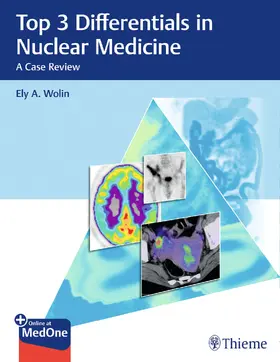 Wolin | Top 3 Differentials in Nuclear Medicine | E-Book | www2.sack.de