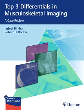 Bindra / Boutin |  Top 3 Differentials in Musculoskeletal Imaging | eBook | Sack Fachmedien