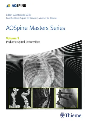 Berven / de Kleuver / Vialle |  Aospine Masters Series, Volume 9: Pediatric Spinal Deformities | Buch |  Sack Fachmedien