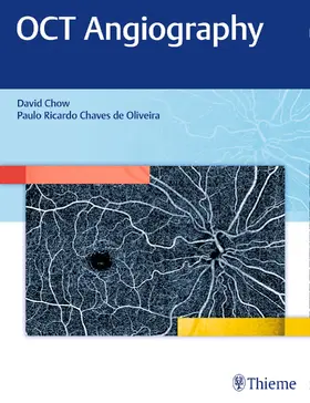 Chow |  Oct Angiography | Buch |  Sack Fachmedien