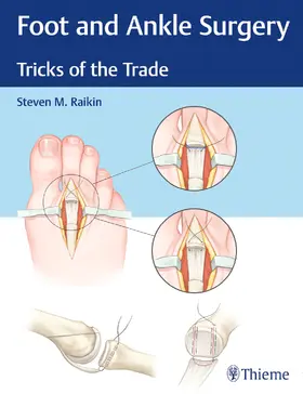 Raikin | Foot and Ankle Surgery | Buch | 978-1-62623-491-8 | www2.sack.de