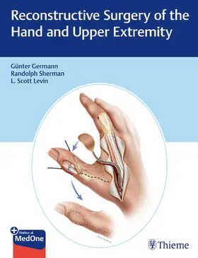 Germann / Levin / Sherman | Reconstructive Surgery of the Hand and Upper Extremity | Medienkombination | 978-1-62623-601-1 | sack.de