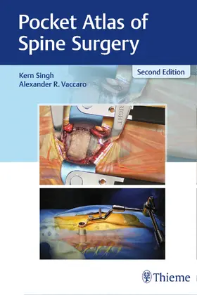 Singh / Vaccaro |  Pocket Atlas of Spine Surgery | Buch |  Sack Fachmedien