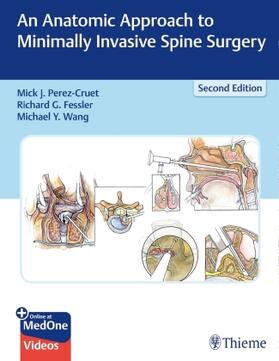 Perez-Cruet / Fessler / Wang | An Anatomic Approach to Minimally Invasive Spine Surgery | Medienkombination | 978-1-62623-643-1 | sack.de
