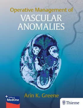 Greene |  Operative Management of Vascular Anomalies | Buch |  Sack Fachmedien