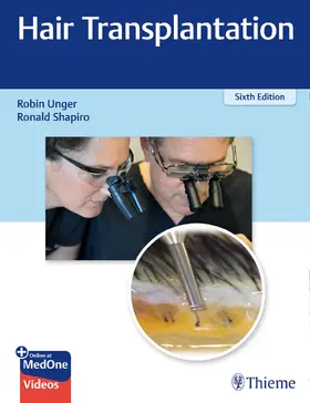 Unger / Shapiro |  Hair Transplantation | Buch |  Sack Fachmedien