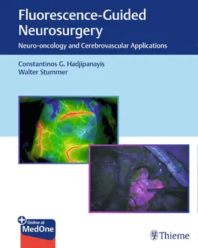 Hadjipanayis / Stummer |  Fluorescence-Guided Neurosurgery | Buch |  Sack Fachmedien