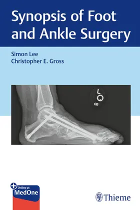 Lee / Gross |  Synopsis of Foot and Ankle Surgery | Buch |  Sack Fachmedien