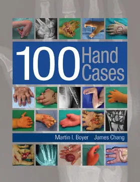 Boyer / Chang |  100 Hand Cases | eBook | Sack Fachmedien