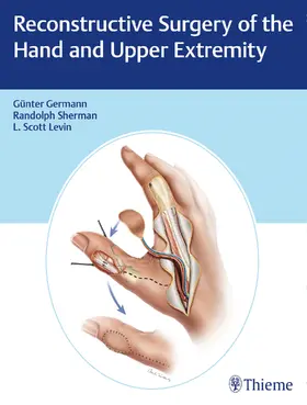 Germann / Levin / Sherman | Reconstructive Surgery of the Hand and Upper Extremity | E-Book | sack.de