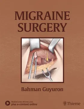 Guyuron |  Migraine Surgery | eBook | Sack Fachmedien