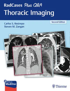 Restrepo / Zangan | Radcases Plus Q&A Thoracic Imaging | Buch | 978-1-62623-814-5 | sack.de