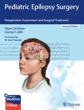 Cataltepe / Jallo |  Pediatric Epilepsy Surgery | Buch |  Sack Fachmedien