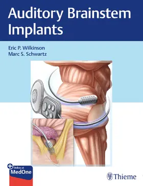 Wilkinson / Schwartz | Auditory Brainstem Implants | E-Book | www2.sack.de