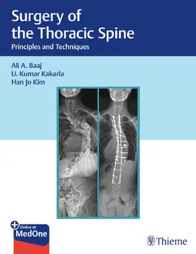 Kakarla / Baaj / Kim |  Surgery of the Thoracic Spine | Buch |  Sack Fachmedien