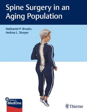Brooks / Strayer | Spine Surgery in an Aging Population | E-Book | www2.sack.de