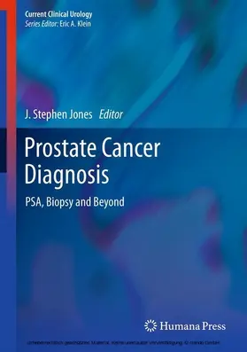 Jones |  Prostate Cancer Diagnosis | eBook | Sack Fachmedien