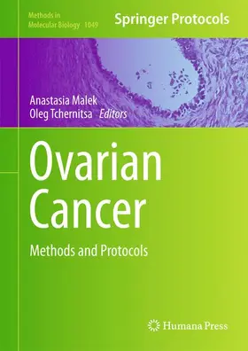 Tchernitsa / Malek |  Ovarian Cancer | Buch |  Sack Fachmedien