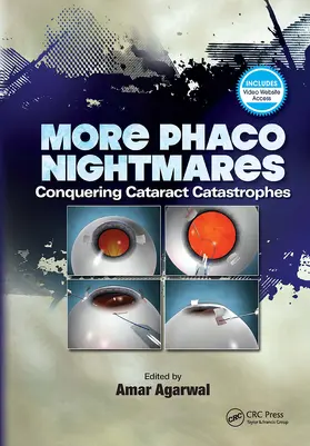 Agarwal |  More Phaco Nightmares | Buch |  Sack Fachmedien