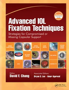 Chang |  Advanced IOL Fixation Techniques | Buch |  Sack Fachmedien