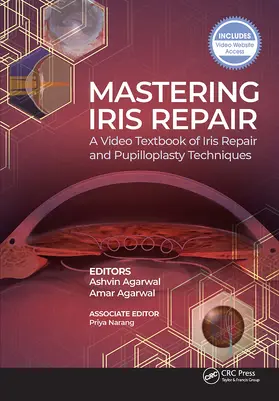 Agarwal |  Mastering Iris Repair | Buch |  Sack Fachmedien