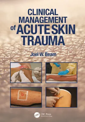 Beam |  Clinical Management of Acute Skin Trauma | Buch |  Sack Fachmedien
