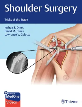 Dines / Gulotta |  Shoulder Surgery | eBook | Sack Fachmedien