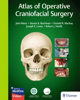 Mesa / Buchman / Mackay | Atlas of Operative Craniofacial Surgery | E-Book | sack.de