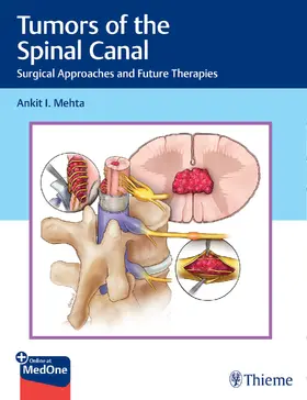 Mehta | Tumors of the Spinal Canal | E-Book | sack.de
