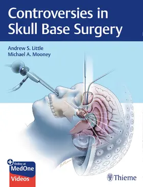 Little / Mooney | Controversies in Skull Base Surgery | E-Book | sack.de